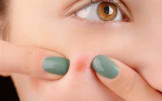 Почему появляются прыщи на лице перед месячными? Узнайте причины и решения