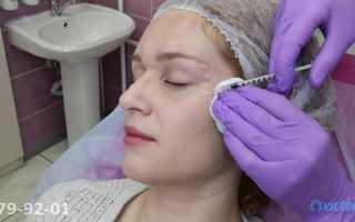 Процедура Full Face в косметологии: какие показания и плюсы у техники для красоты