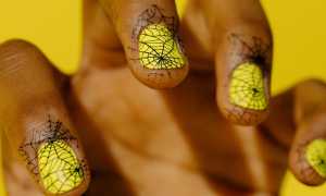 Поперечные линии Бо на ногтях и их лечение: каковы причины появления борозд и методы устранения