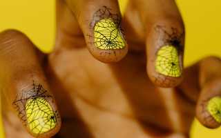 Поперечные линии Бо на ногтях и их лечение: каковы причины появления борозд и методы устранения