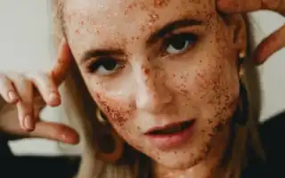 Узловатая эритема кожи и её симптомы – какое лечение эффективно для здоровья