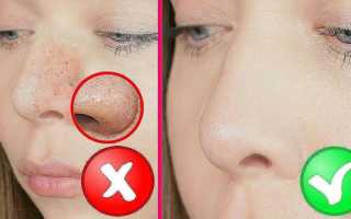 Способы очистить поры глубоко: лучшие средства для кожи лица и их применение