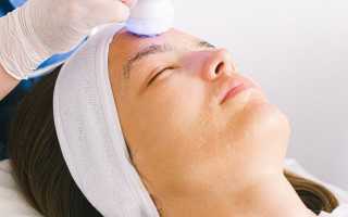 Радиолифтинг лица с ФОТО ДО и ПОСЛЕ сеансов: как часто можно делать процедуру для достижения лучших результатов