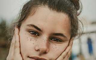 Почему люди получают удовольствие от выдавливания прыщей? Психология и причины