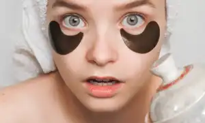 ТОП-20 причин, почему появляются круги под глазами у женщин и как с ними бороться