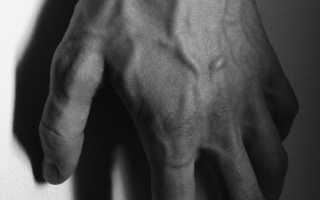 Почему у парней выпирают вены? Причины и особенности