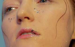 Причины появления бородавок на теле и способы их устранения: полезные советы