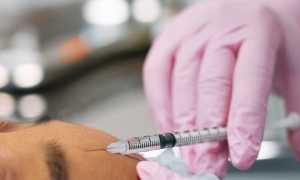 Применение сферогеля light, medium и long в косметологии для лица: особенности и преимущества