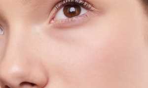 Уход за комбинированной кожей лица: какие основные принципы и особенности ты должна знать для здоровья