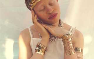 Почему выпадают брови и ресницы: внешние и внутренние причины выпадения волос