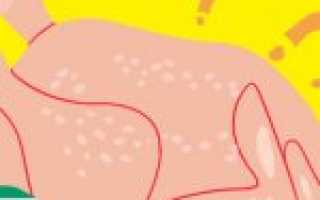 Нужно ли мыть курицу из магазина? Мнения экспертов